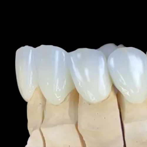 Corone in Zirconio