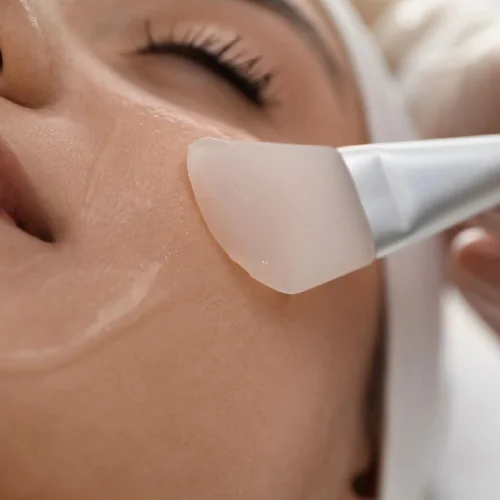 Peeling Chimici